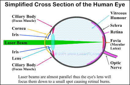 Lens of the eye focuses a laser beam buring the retina